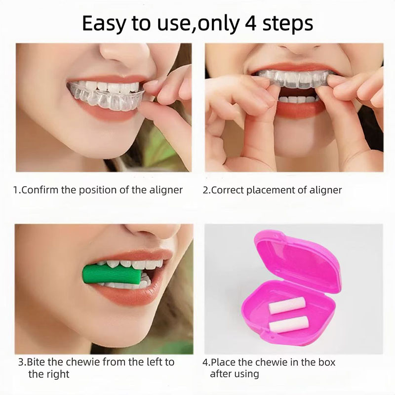 5 paar/set Tand Chew Aligners  - Alignment Stick Set recensie en prijs